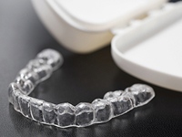 マウスピースのお渡し・治療開始イメージ画像